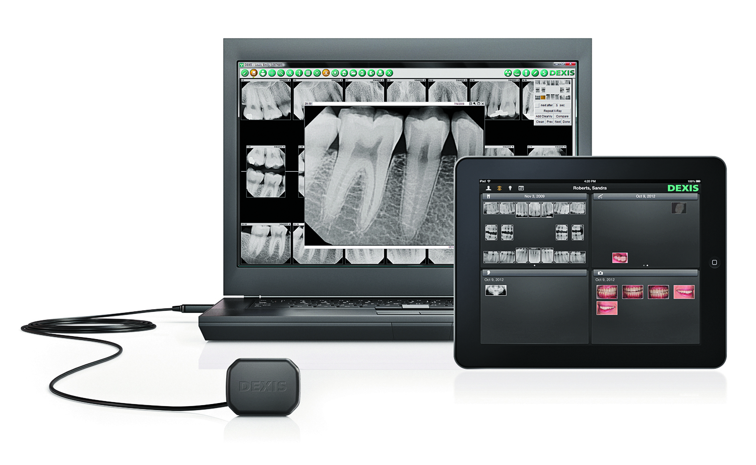 Digital Radiography at Arlington Dental Associates